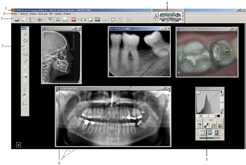 Kodak Dental Imaging Software Overview Imaging Window Overview The Imaging Window is the main imaging interface that provides you with the imaging functions.