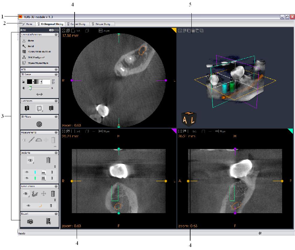 Kodak Dental Imaging Software Overview To access the Orthogonal Slicing window, on the Home Page click the Orthogonal Slicing tab.