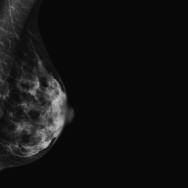 It s the only system available today that measures and selects exposure parameters based on radiological breast density measurements.