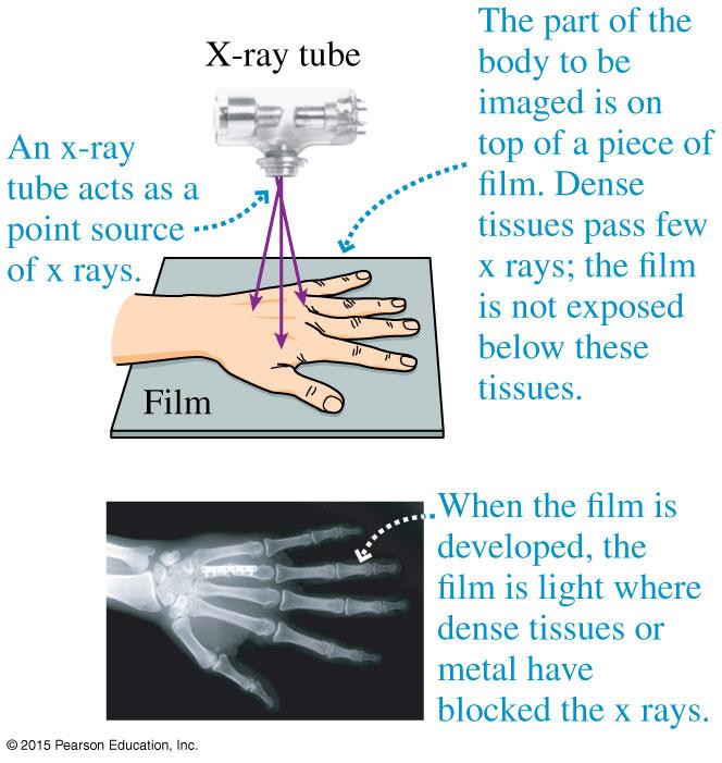 28.1 X-ray images An x-ray image is created when x rays are