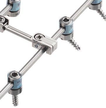 Titanium multi-axial screws achieve up to 100 of maximum conical angulation.