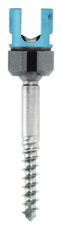 5mm 200/200mm, 200/300mm, 300/300mm lengths Titanium or Cobalt Chrome Occipital Rod: 3.