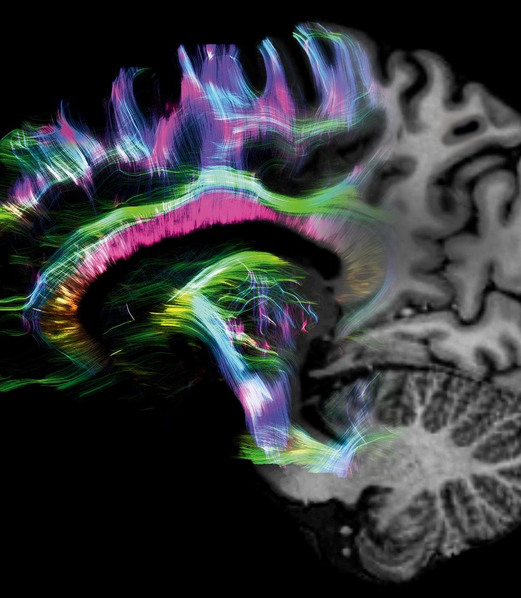 Cinematic Volume Rendering Technique (VRT): a research visualization technology that here enables a high-resolution, anatomical image of the brain, merged with colorful tractography data.