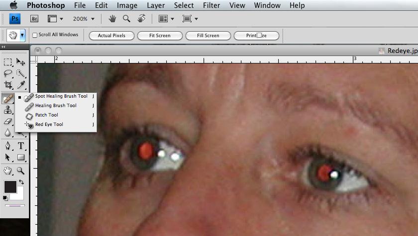 Get the red eye out What causes red eye? The camera flash is reflecting off the retina (back of the eye).