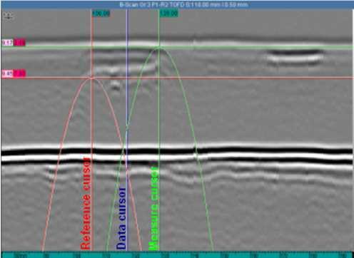 Flaws parallel to the pipe surface can be measured on the B-scan by positioning the hyperbolic cursors at