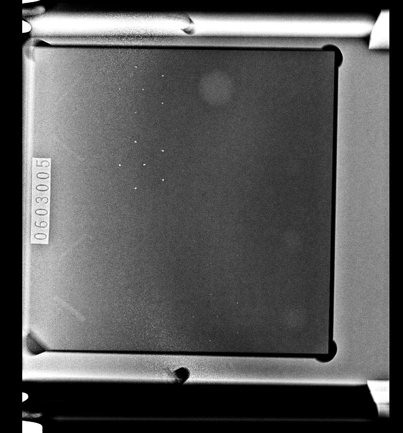 Magnification image of the ACR Accreditation phantom on a detector as it starts to fail.