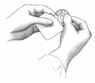 Hand reel to surgeon as needed, being certain that the end of the ligating material is free to grasp. 4. Surgeon holds reel in palm, feeds strand between fingers, and places around tip of hemostat.