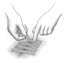 Peel off tapes as needed in diagonal direction. 4. When healing is judged to be adequate, remove each tape by peeling off each half from the outside toward the wound margin.