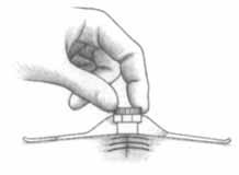 The needle of the looped suture is passed through the fascia from inside out at one end of the incision, then through the opposite wound edge from outside in, and then passed through the loop.
