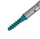 Bone Screw Insertion Screws may be placed using either the Retaining Screwdriver or the Quick Turn Screwdriver.