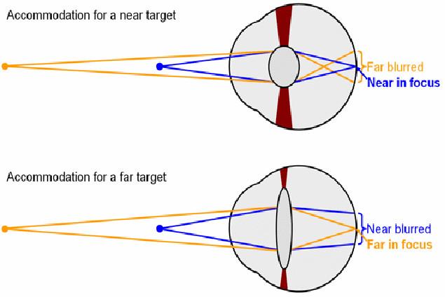 The near point P n of the eye is the closest distance the eye can bring into focus (about 25 cm).