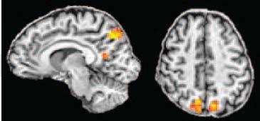 3. Research on Human Brain Goal: Understand the mechanism of intuition Analysis of activation site in brain and its