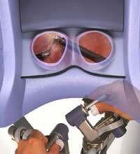 Surgeon s view when using the Da Vinci surgical system 3.