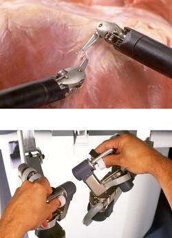 Vinci Surgical System on April 27, 2001, he prepared to make history yet again-- becoming the first cardiothoracic surgeon in Southern California to perform heart surgery using a robot.