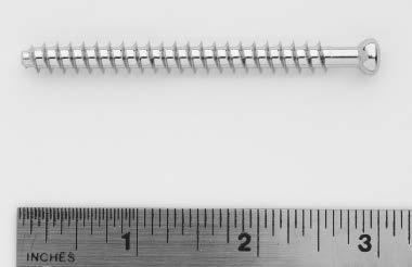 7.0 mm Cannulated Screws Features Cannulated shaft accepts 2.0 mm diameter guide wires (threaded and nonthreaded wires available).