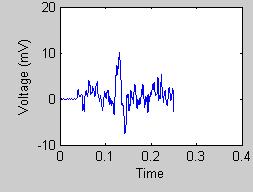 www.ijcsi.org 284 Fig. 19: Frequency response of ECG signal after application of notch filter 5.