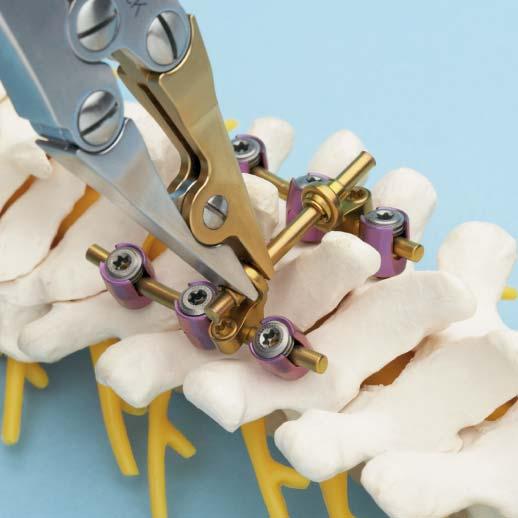 Locking one end of the transconnector with the crimper may facilitate placement. Note: All setscrews are designed to be near flush to the top of the implant when locked.