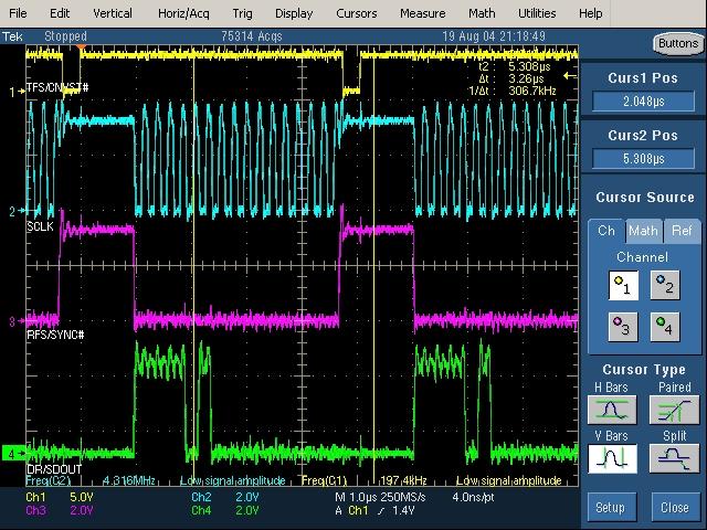 Figure 4. ADSP-21065L SPORT Interfce with AD7676 Oscilloscope Cpture of Interfce Signls As shown in Figure 4, the ADC drives seril dt on the seril clock's flling edges.