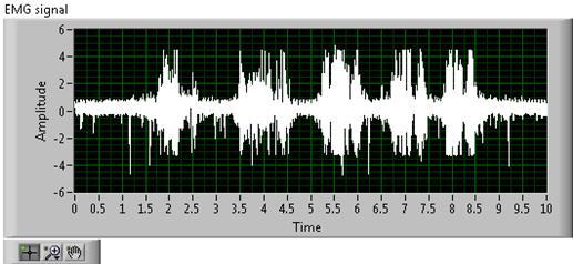 EXPECTED RESULTS The EMG signals measured from both circuits in the sequence of first in first out.