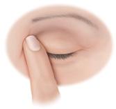 7. Close your eyes (do not blink) and apply pressure to the point where the lids meet the nose. Hold for two to three minutes. Notes 8.