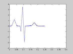 removed, producing a near clean ECG signal of fig 19, almost devoid of corruption.