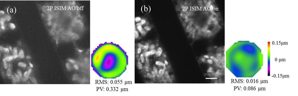 Supplementary Figure 7 2P ISIM images of Zygnema algae. Before (a) and after (b) wavefront correction.