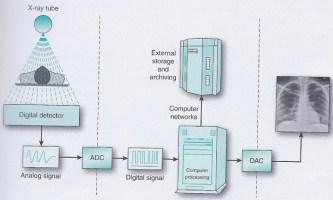 A DIGITAL RADIOGRAPHIC IMAGING SYSTEM: Data Acquisition Computer Data