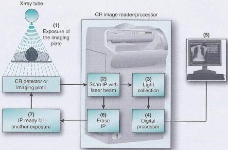 COMPUTED RADIOGRAPHY (CR) Fundamental steps in the production of a CR image.
