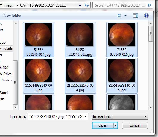 Navigate to the file folder where the CATT patient s color