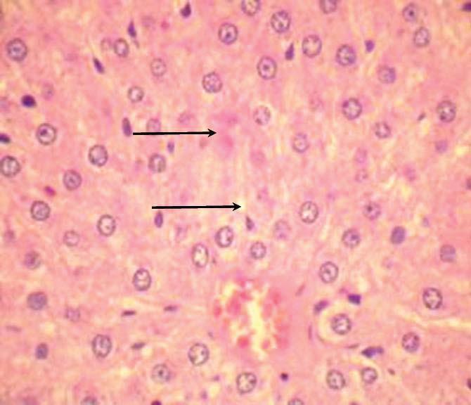 angiohururg varicoză