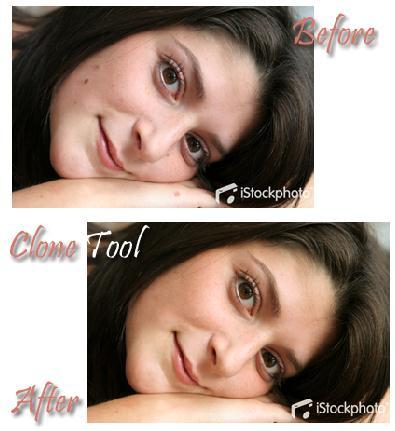 Retouching Portraits in Photoshop I Removing Blemishes When removing blemishes, acne or other imperfections on the skin, our goal is to maintain as much of the original skin texture as possible.