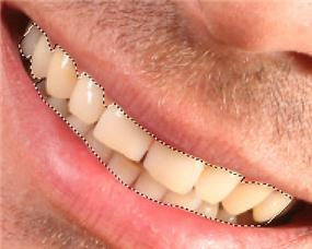 Carefully draw a selection around the teeth, being careful not to select any of the gums or lips.