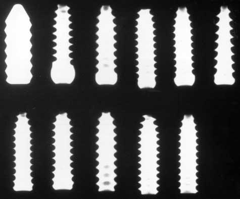 Bottom row, left to right: Innovasive Tapered Head interference screw, Smith & Nephew Soft Silk, Linvatec Propel, DePuy Kurosaka Advantage, and Arthrex flat-head screws.