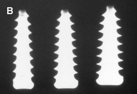 These screws have considerable variation in the screw head recesses (Trilobe, Sixstar torx, quadrangular, and tapered hexagonal).