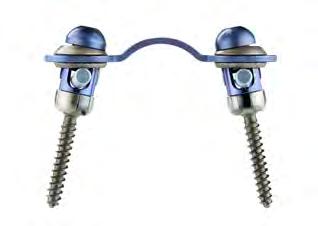 Strength Polyaxial Screw Pull Out