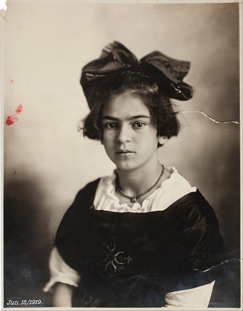 At the age of 5, Frida contracted polio and although she recovered her right leg was