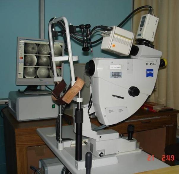 Fig. 3.1: Zeiss FF 450IR fundus camera. Apart from the KMC database, two publicly available retinal databases called DRIVE (Staal et al., 2004) and STARE (Hoover et al.
