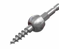 Temporary Fixation Pins are available to hold the plate during screw hole preparation.