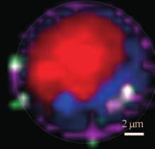 More particularly, Raman imaging provides the spatial distribution of the various molecular