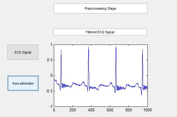 Fig.10: MATLAB GUI simulation result of preprocessing stage Fig.