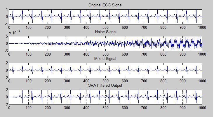 Fig 3: Simulation waveform for Final Filtered Output of SRA Fig 4: Simulation waveform for Final Filtered Output of ENLMS algorithm It can be well inferred from the figures given above that the