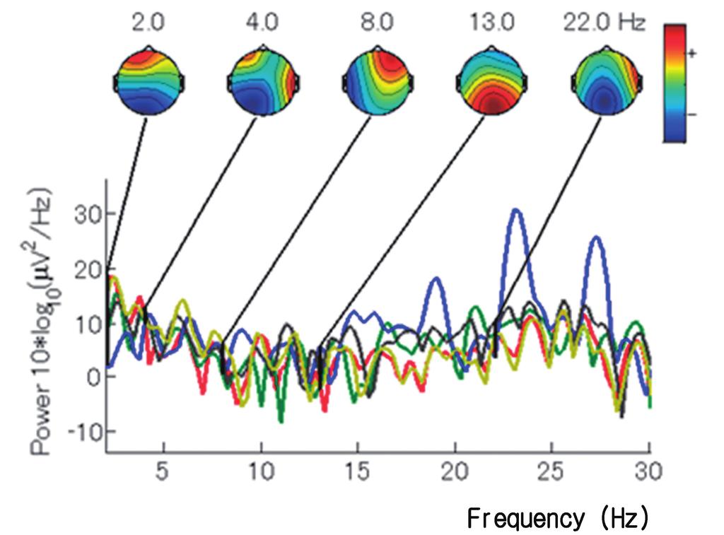Fig. 5 Brain Activity Spectrum: immersive VR environment (IVR) Fig. 6.