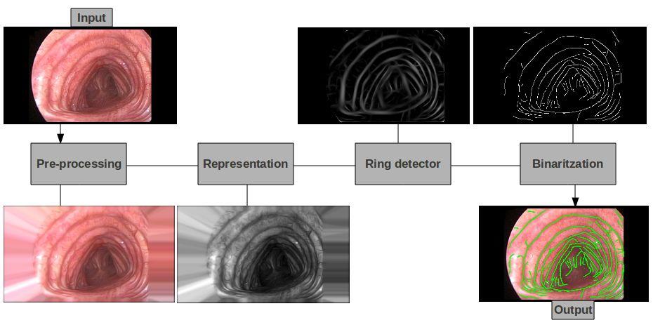 Chapter 3 Detecting tracheal rings : workflow Figure 3.1: Workflow for segmenting tracheal rings The strategy we propose to detect tracheal rings covers four main stages: 1. Pre-processing.