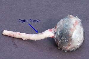 Eyes Optic Nerve Made up of the axons of the Ganglion