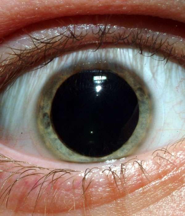 Eyes Made up of the: Pupil (Dark opening)