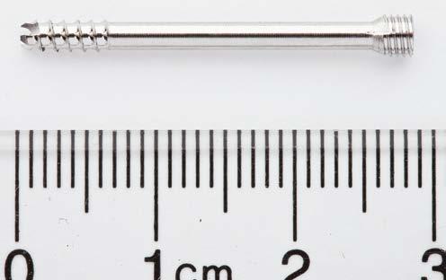 Implants 2.4 mm Headless s, short thread Shaft thread (T) approximately 20% of screw length (L) Stainless Length Thread Steel Titanium (mm) length (mm) 02.226.209 04.226.209 9 4 02.226.210 04.226.210 10 4 02.