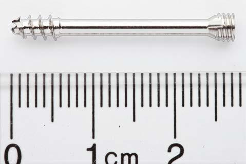 Implants 3.0 mm Headless s, short thread Shaft thread (T) approximately 20% of screw length (L) Stainless Length Thread Steel Titanium (mm) length (mm) 02.226.010 04.226.010 10 4 02.226.011 04.226.011 11 4 02.