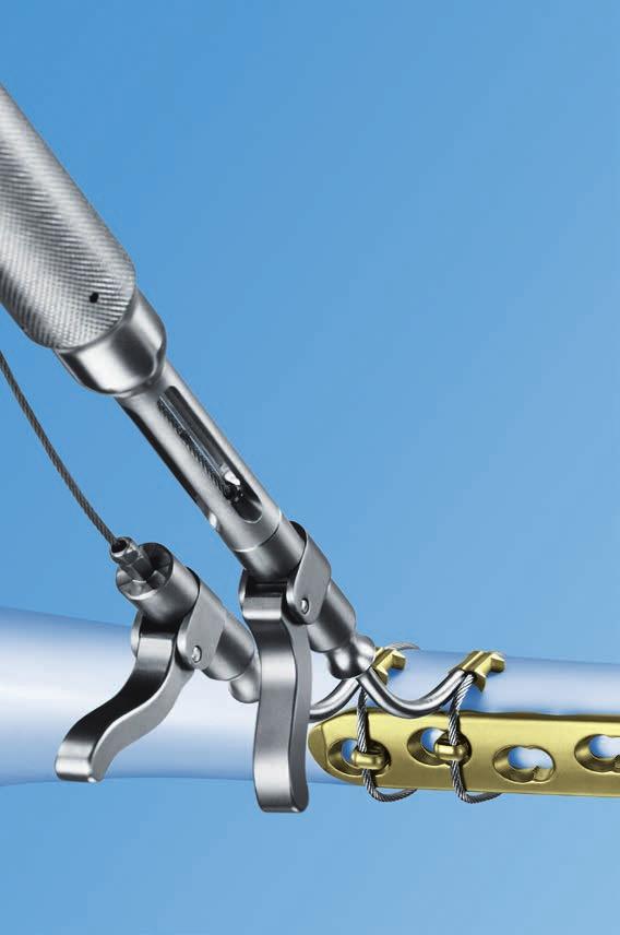 Easy crimping A ratchet mechanism controls the amount of crimp and deformation.