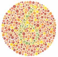 Men are 250 times more likely to have color blindness than