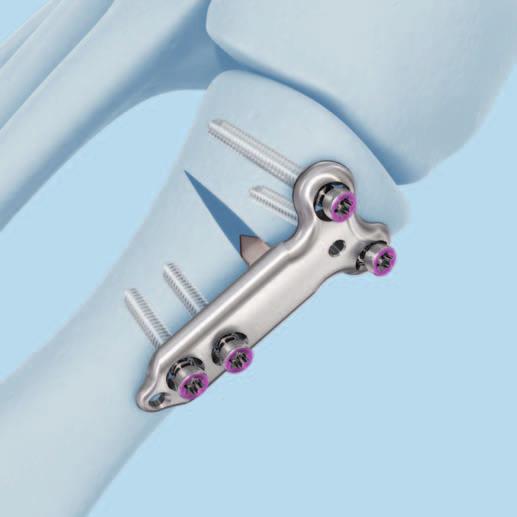 Implant Removal Instruments VA screws 2.4/2.7 mm 314.467 Screwdriver Shaft, Stardrive, T8, self-holding 03.111.